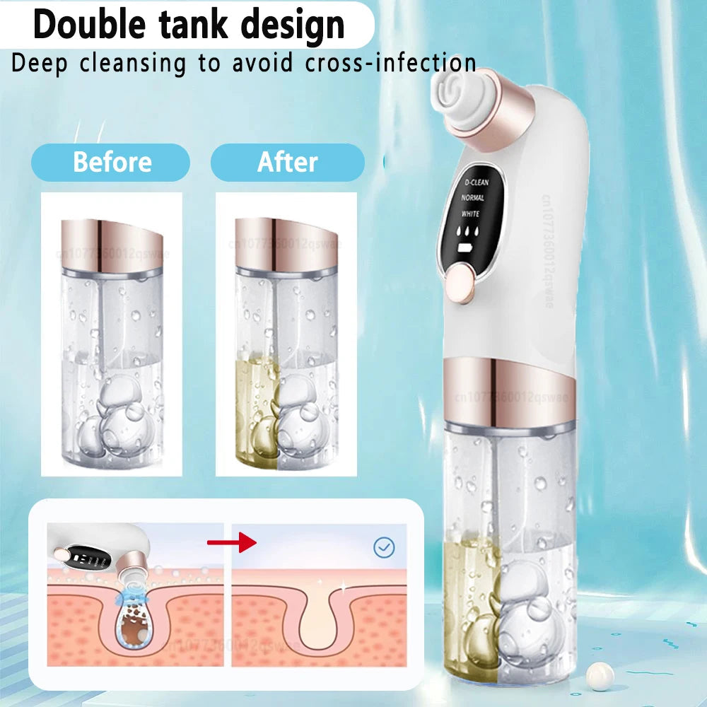 Pore Vacuum Cleaner Blackhead Remover
